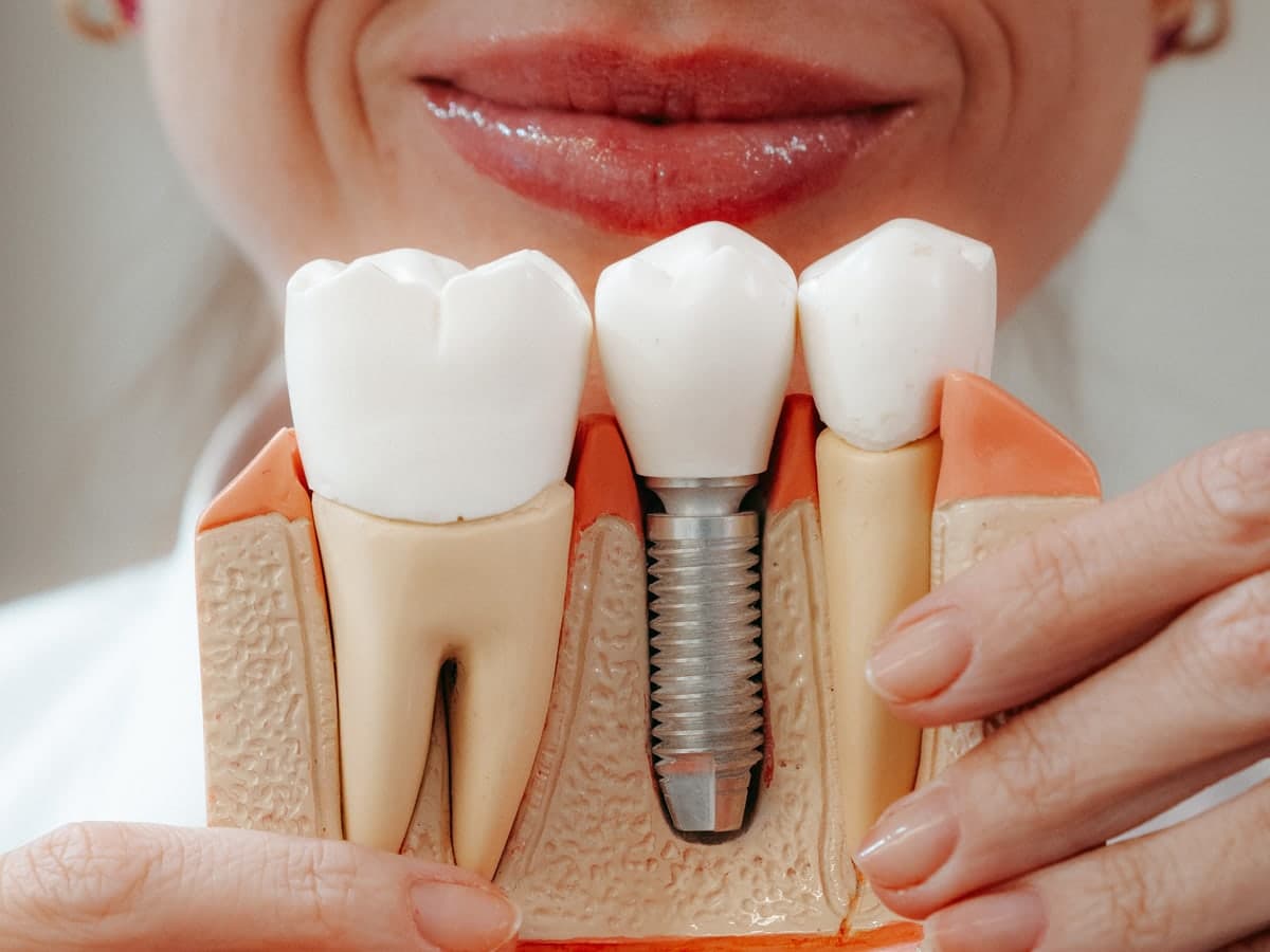 Profissional da OralClin explicando o tratamento com um modelo de implante